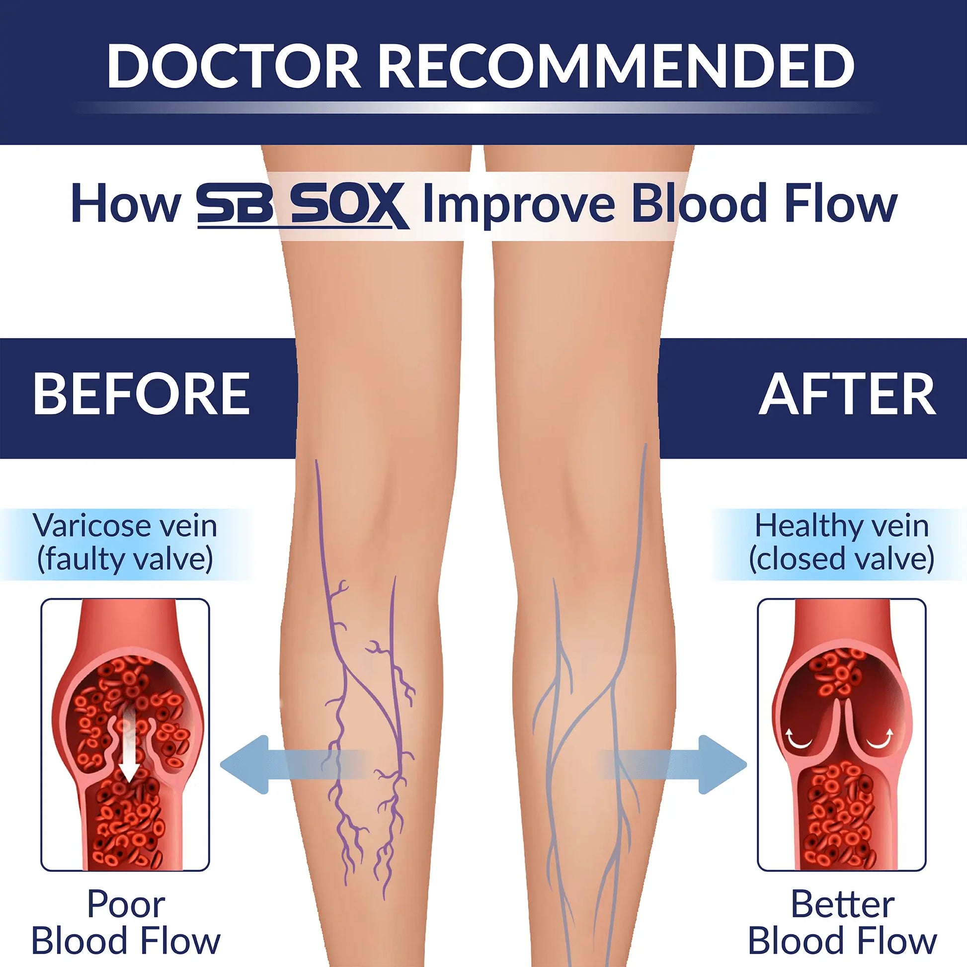 Illustration of legs before and after using SB SOX to improve blood flow, with varicose veins shown before and healthy veins shown after.